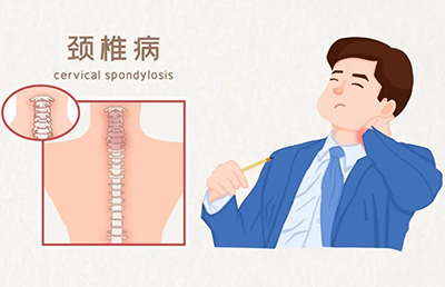 警惕！骨與關(guān)節(jié)的“健康危機(jī)”，你中招了嗎？